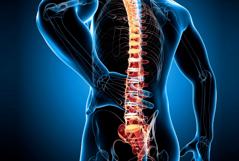osteocondrose