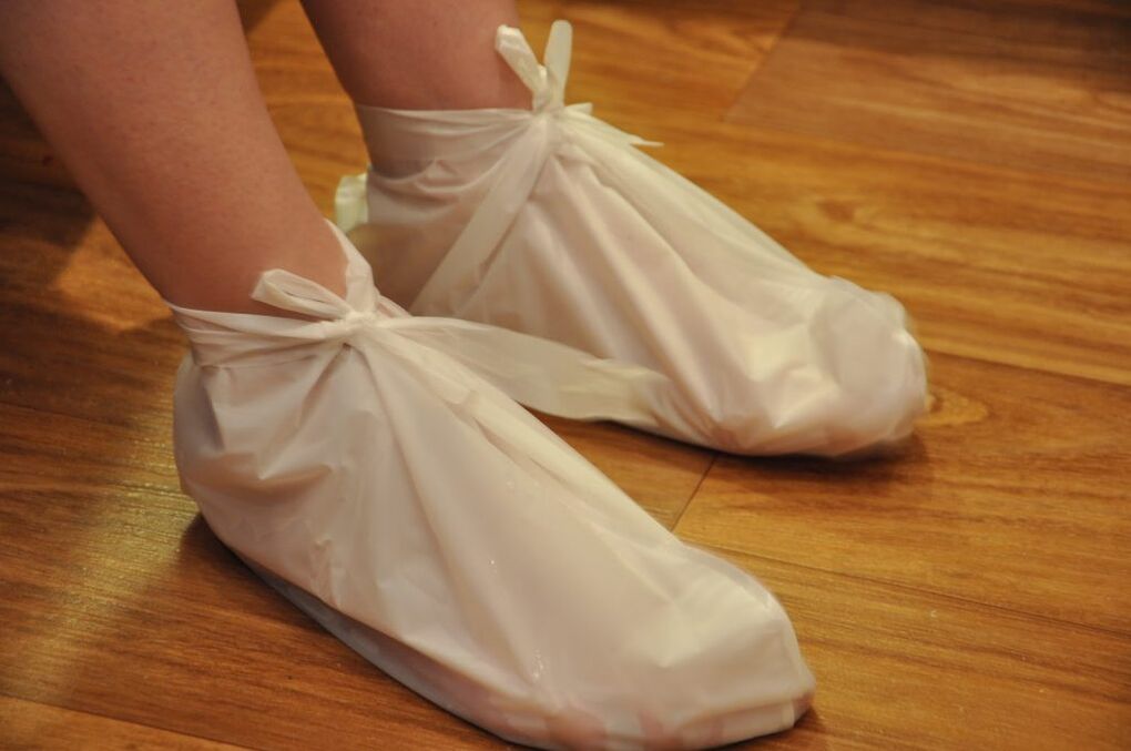 compressas para artrose do tornozelo