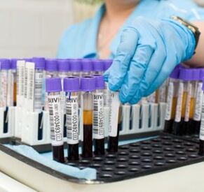 exame de sangue para diagnosticar dores nas articulações
