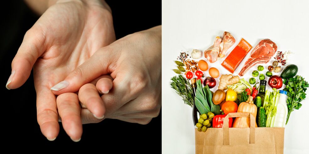 artrite gotosa das mãos e alimentos para seu tratamento