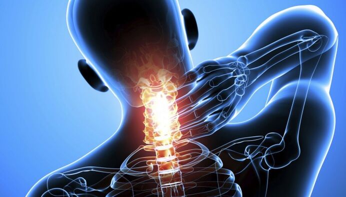 dor na coluna cervical