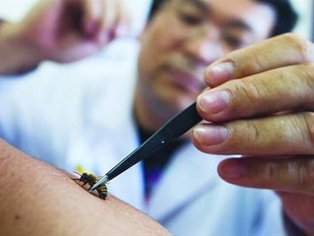 apiterapia para osteocondrose cervical