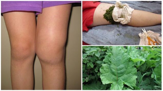 compressa de ervas para osteoartrite do joelho